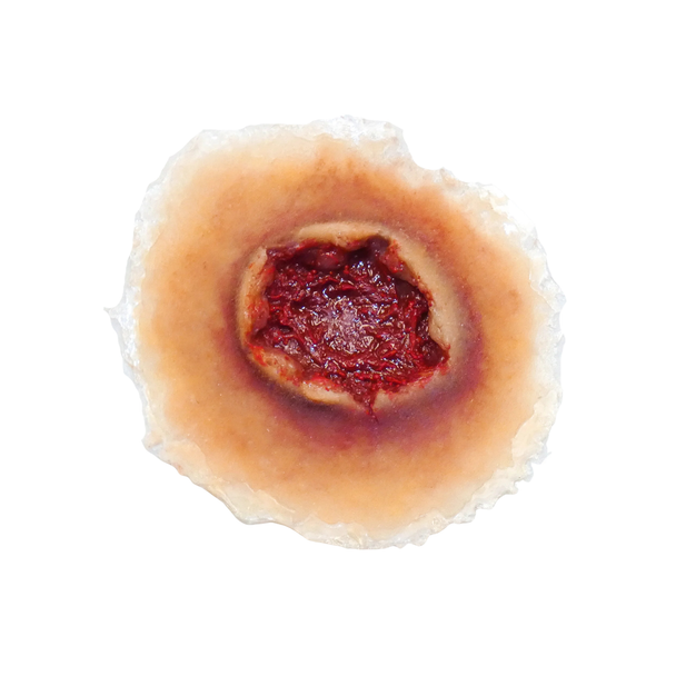Techline Trauma Gunshot Exit Wound - Large