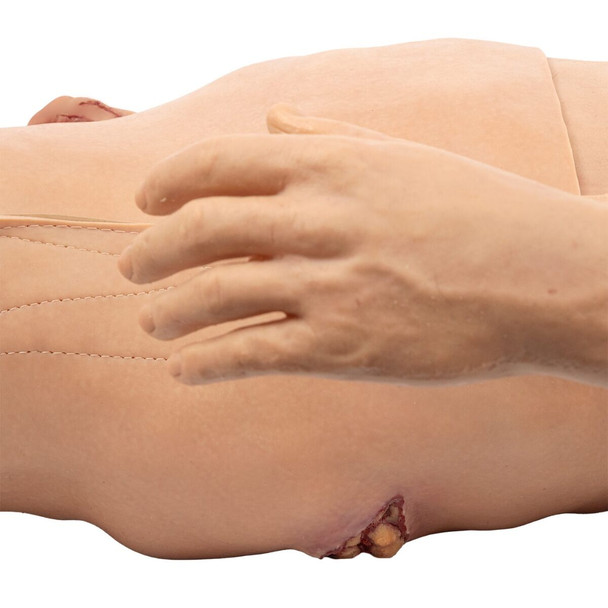 TOMManikin GSW with Amputation