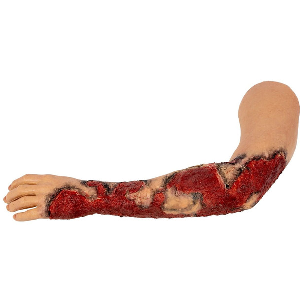  TOMManikin Burn Left Arm