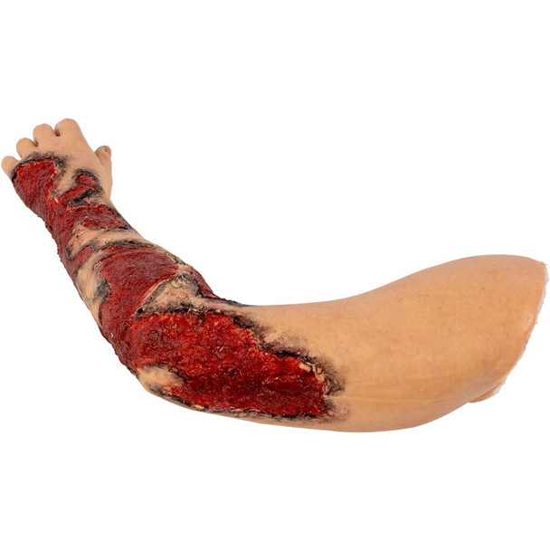  TOMManikin Burn Left Arm