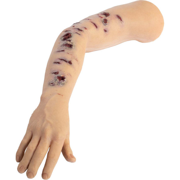 TOMManikin Shrapnel Injury Right Arm