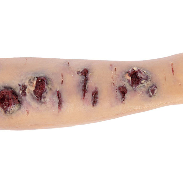 TOMManikin Shrapnel Injury Right Arm