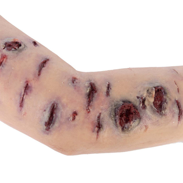 TOMManikin Shrapnel Injury Right Arm