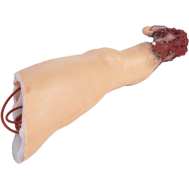 Tommanikin Right Leg w/ Partial Amputation