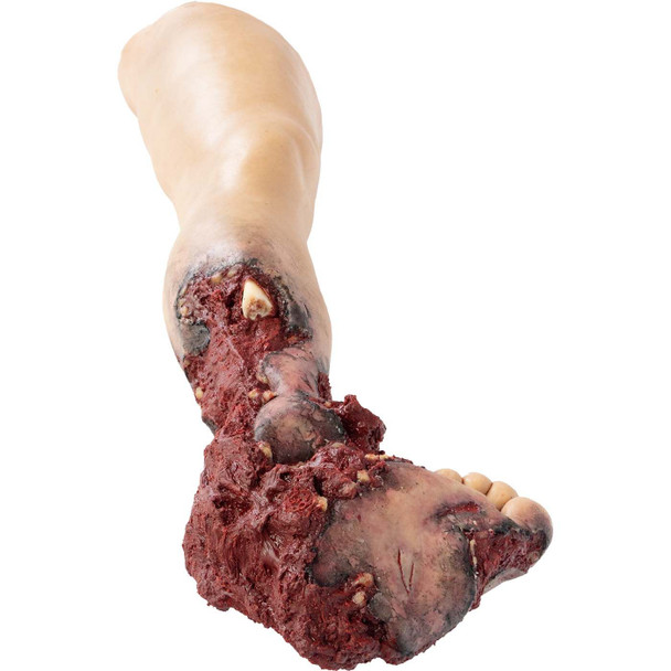 Tommanikin Right Leg w/ Partial Amputation