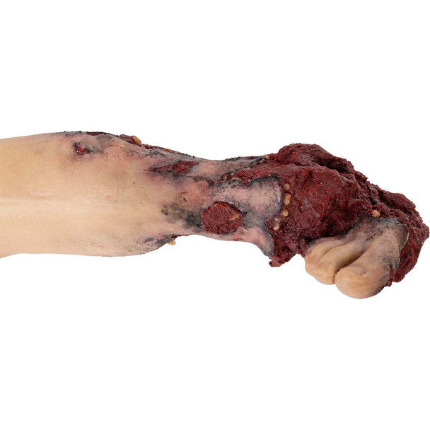 Tommanikin Right Leg w/ Partial Amputation