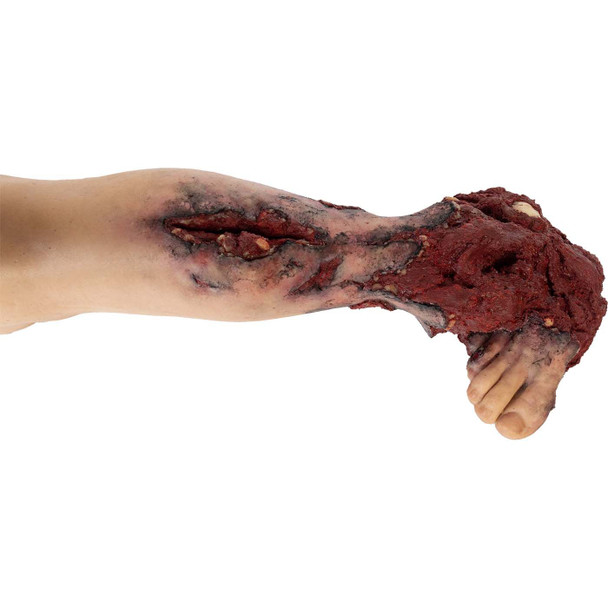 Tommanikin Right Leg w/ Partial Amputation