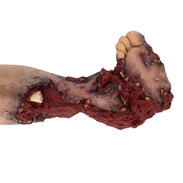 Tommanikin Right Leg w/ Partial Amputation