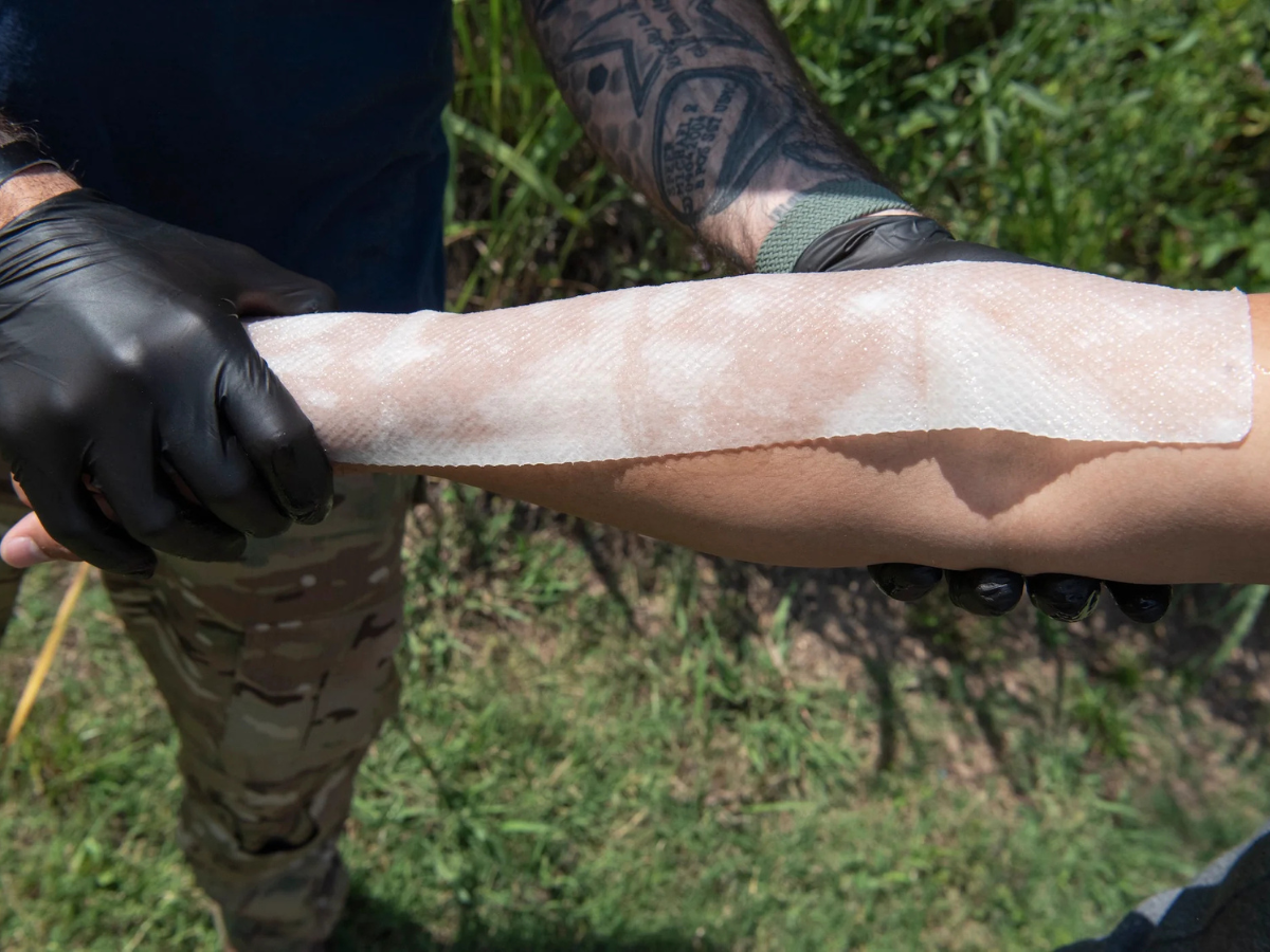 Burn Injury Dressings