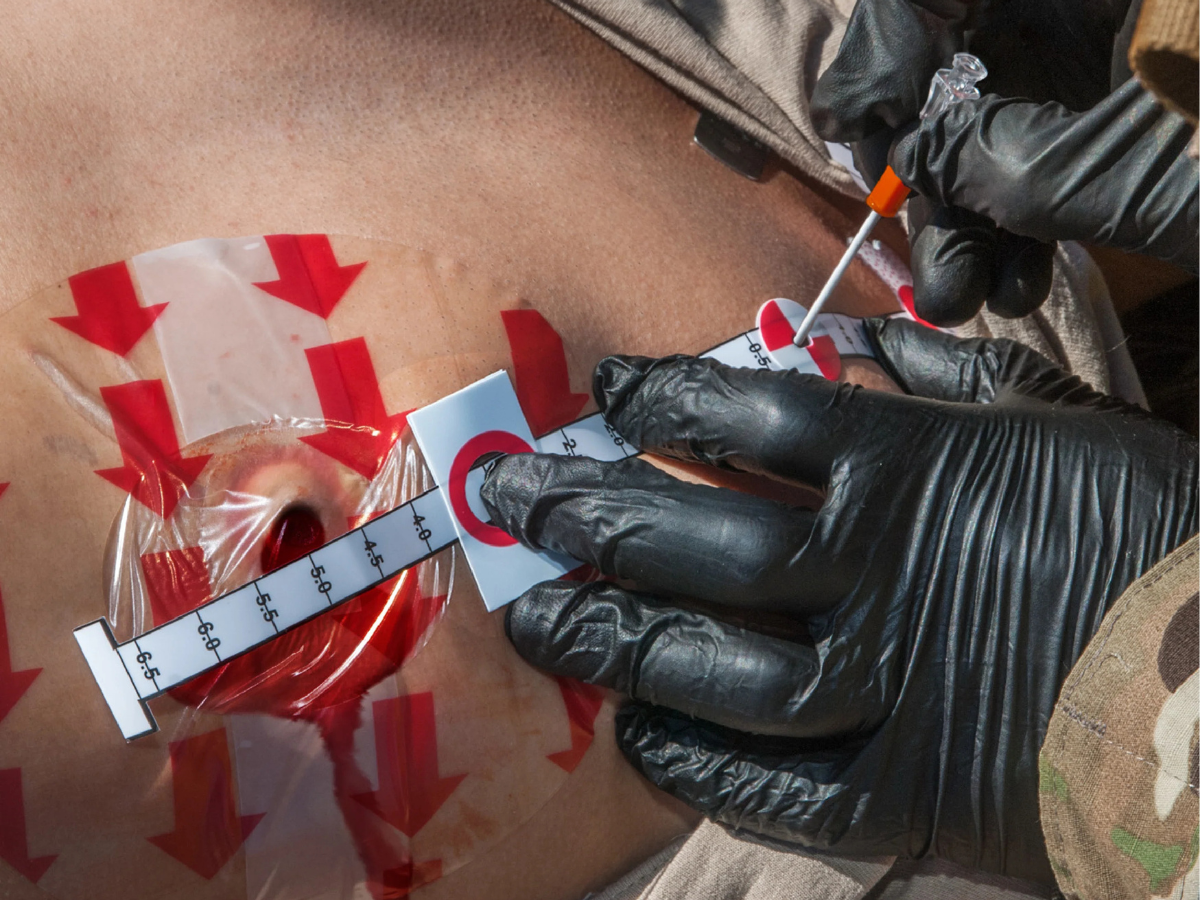 Decompression Needles