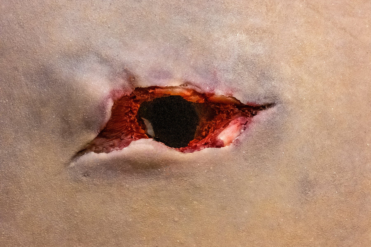 shrapnel wound simulation