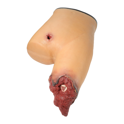 Simulated traumatic amputation wound moulage