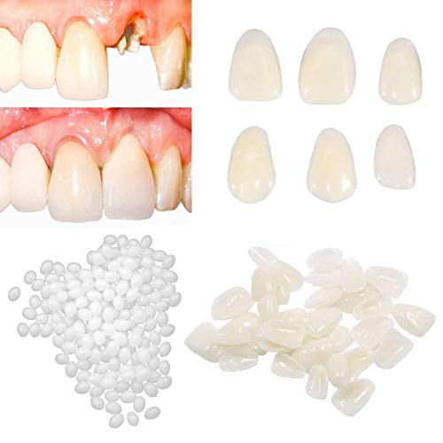 Brige Temporary Tooth Repair kit for Filling The Missing Broken Tooth and Gaps-Moldable Fake Teeth and Thermal Beads Replacement Kit Artfifical Teeth