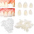 Brige Temporary Tooth Repair kit for Filling The Missing Broken Tooth and Gaps-Moldable Fake Teeth and Thermal Beads Replacement Kit Artfifical Teeth