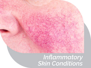 Inflammatory Skin Conditions