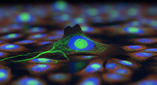 Comparing IGF-1 LR3 Kit Formats for High-Throughput Screening