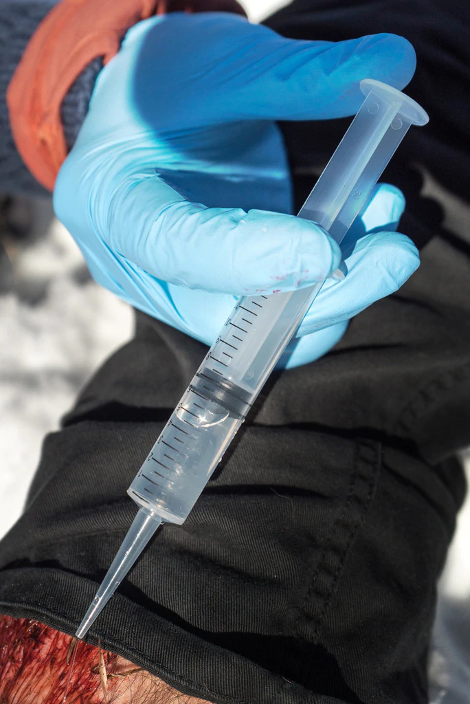 12cc Irrigation Syringe