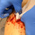 RE SIM Wound Packing Task Trainer