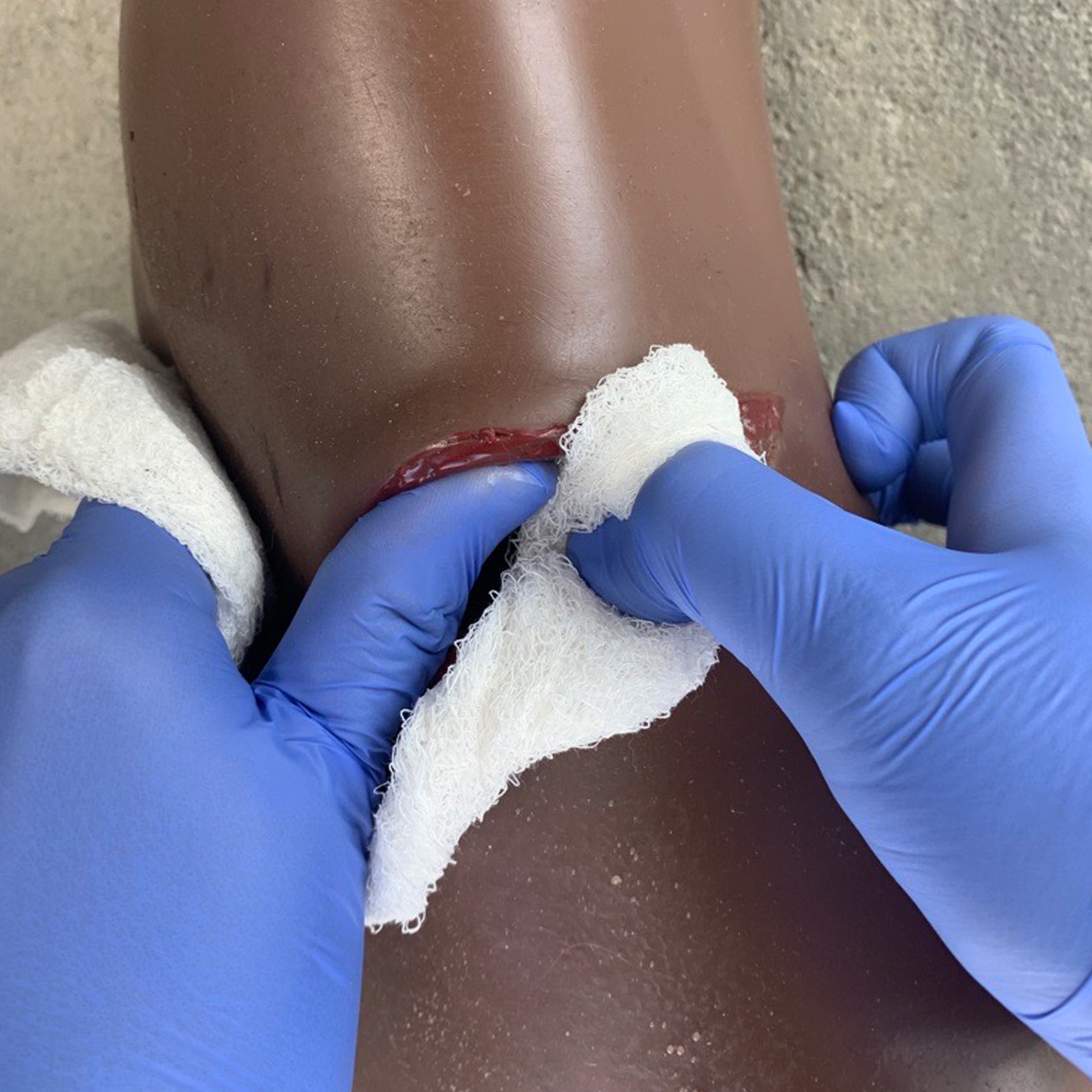 bleeding control training wound packing