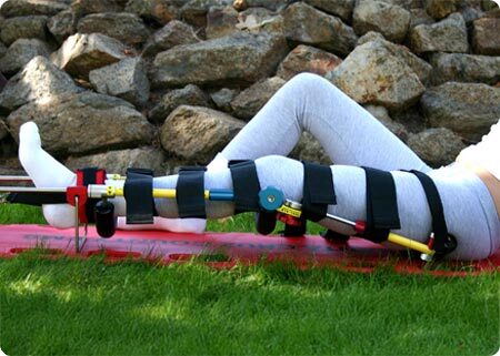 Woman in a splint outdoors