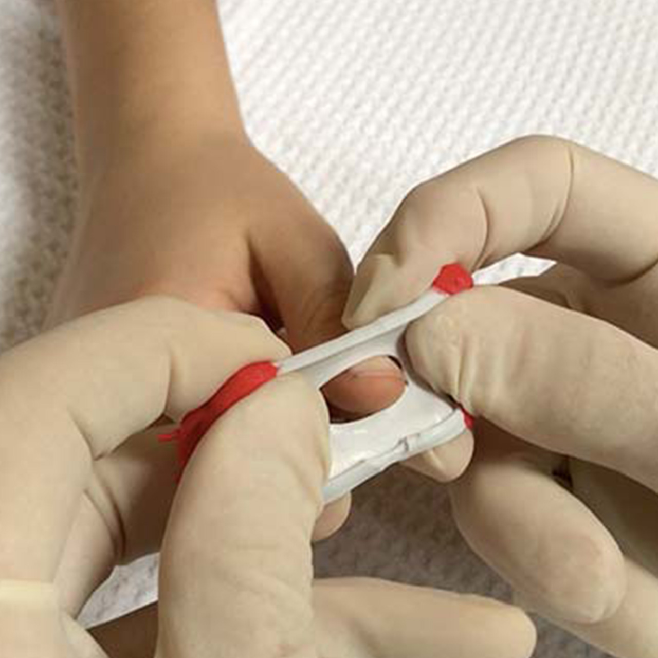 T-Ring Flex Finger Tourniquet, image size:1280x1280