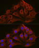 Immunofluorescence analysis of C6 cells using β-Tubulin Mouse mAb (CABC021) at dilution of 1:100 (40x lens). Blue: DAPI for nuclear staining.