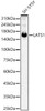 Anti-LATS1 [ARC56891] Monoclonal Antibody (CAB22287)
