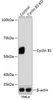 Anti-Cyclin B1 Monoclonal Antibody -Knockout Validated (CAB19037)