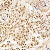 Anti-MDM2 [ARC60294] Monoclonal Antibody (CAB23387)