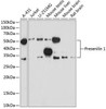 Anti-Presenilin 1 Monoclonal Antibody (CAB19103)