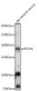 Anti-PTCH1 Antibody (CAB14772)
