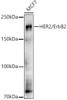 Anti-HER2/ErbB2 Polyclonal Antibody (CAB21768)