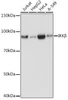 Anti-IKKbeta Monoclonal Antibody (CAB19606)