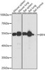 Anti-IRF4 Antibody (CAB0524)