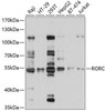 Anti-RORC Antibody (CAB10240)