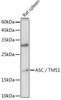 Anti-ASC/TMS1 Antibody (CAB1170)