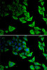 Anti-alpha-Synuclein Antibody (CAB7215)