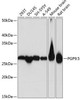 Anti-PGP9.5/UCHL1 Monoclonal Antibody (CAB19101)