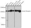 Anti-Insulin Receptor Monoclonal Antibody (CAB19067)