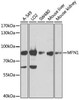 Anti-MFN1 Antibody (CAB9880)