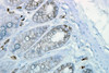 Immunohistochemistry analysis using Mouse Anti-Hsp90 Monoclonal Antibody, Clone H9010 (STMA00005). Tissue: inflamed colon. Species: Mouse. Fixation: Formalin. Primary Antibody: Mouse Anti-Hsp90 Monoclonal Antibody (STMA00005) at 1:10000 for 12 hours at 4°C. Secondary Antibody: Biotin Goat Anti-Mouse at 1:2000 for 1 hour at RT. Counterstain: Mayer Hematoxylin (purple/blue) nuclear stain at 200 µl for 2 minutes at RT.