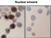 Immunocytochemistry/Immunofluorescence analysis using Mouse Anti-Hsp70 Monoclonal Antibody, Clone BB70 (STMA00004). Tissue: hepatocyte nuclei. Species: Rat. Primary Antibody: Mouse Anti-Hsp70 Monoclonal Antibody (STMA00004) at 1:200. Liver sections were paraffin embedded. First pictures in series show two hours after exposure to stress, the second shows the control. Courtesy of: G. Matic, University of Belgrade, Serbia.