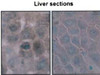 Immunohistochemistry analysis using Mouse Anti-Hsp70 Monoclonal Antibody, Clone BB70 (STMA00004). Tissue: hepatocytes. Species: Rat. Fixation: Paraffin Embedded. Primary Antibody: Mouse Anti-Hsp70 Monoclonal Antibody (STMA00004) at 1:200. Liver sections were paraffin embedded. First pictures in series show two hours after exposure to stress, the second shows the control. Courtesy of: G. Matic, University of Belgrade, Serbia.