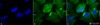 Immunocytochemistry/Immunofluorescence analysis using Mouse Anti-CD74 Monoclonal Antibody, Clone PIN 1.1 (STMA00011). Tissue: Cervical cancer cell line (HeLa). Species: Human. Fixation: 2% Formaldehyde for 20 min at RT. Primary Antibody: Mouse Anti-CD74 Monoclonal Antibody (STMA00011) at 1:100 for 12 hours at 4°C. Secondary Antibody: FITC Goat Anti-Mouse (green) at 1:200 for 2 hours at RT.