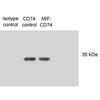 Western Blot analysis of Human N87 cell lysates showing detection of CD74 protein using Mouse Anti-CD74 Monoclonal Antibody, Clone PIN 1.1 (STMA00011). Primary Antibody: Mouse Anti-CD74 Monoclonal Antibody (STMA00011) at 1:1000. Lysates treated with macrophage inhibitory factor (MIF). Courtesy of: Victor E. Reyes, University of Texas Medical Branch, USA.