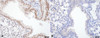 Immunohistochemistry analysis using Rat Anti-HSF1 Monoclonal Antibody, Clone 10H8 (STMA00012). Tissue: Lung. Species: Mouse. Fixation: 10% Formalin Solution for 20 hours at RT. Primary Antibody: Rat Anti-HSF1 Monoclonal Antibody (STMA00012) at 1:1000 for 40 min. Secondary Antibody: Dako labeled Polymer HRP Anti-rat IgG, DAB Chromogen (brown) (Dako Envision+ System) for 30 min at RT.
