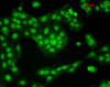 Immunocytochemistry/Immunofluorescence analysis using Mouse Anti-CaMKII Monoclonal Antibody, Clone 6G9 (STMA00015). Tissue: HaCaT cells. Species: Human. Fixation: Cold 100% methanol for 10 minutes at -20°C. Primary Antibody: Mouse Anti-CaMKII Monoclonal Antibody (STMA00015) at 1:100 for 1 hour at RT. Secondary Antibody: FITC Goat Anti-Mouse (green) at 1:50 for 1 hour at RT. Localization: Nuclear Staining.