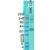 Western Blot analysis of Rat brain membrane lysate showing detection of CaMKII protein using Mouse Anti-CaMKII Monoclonal Antibody, Clone 6G9 (STMA00015). Primary Antibody: Mouse Anti-CaMKII Monoclonal Antibody (STMA00015) at 1:1000.