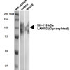 Western Blot analysis of Human, Mouse HEK293 and 3T3NIH cell lysates showing detection of ~100-110 kDa LAMP2 protein using Rat Anti-LAMP2 Monoclonal Antibody, Clone GL2A7 (STMA00024). Lane 1: MW ladder. Lane 2: Human HEK293 lysate (20 µg). Lane 3: Mouse 3T3NIH lysate (10 µg). Block: 5% milk + TBST for 1 hour at RT. Primary Antibody: Rat Anti-LAMP2 Monoclonal Antibody (STMA00024) at 1:500 for 1 hour at RT.