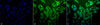Immunocytochemistry/Immunofluorescence analysis using Mouse Anti-Ubiquitin Monoclonal Antibody, Clone 5B9-B3 (STMA00036). Tissue: Cervical cancer cell line (HeLa). Species: Human. Fixation: 2% Formaldehyde for 20 min at RT. Primary Antibody: Mouse Anti-Ubiquitin Monoclonal Antibody (STMA00036) at 1:100 for 12 hours at 4°C. Secondary Antibody: FITC Goat Anti-Mouse (green) at 1:200 for 2 hours at RT.